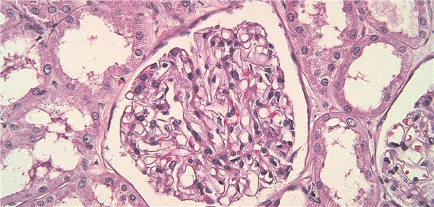 Wunderwerk Nierenkörperchen mit seinem Glomerulus.
