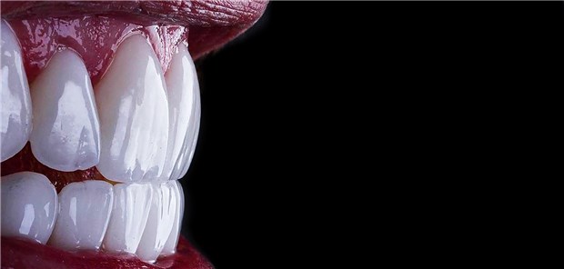 Zähne in Nahaufnahme: Ein Mann wurde von seiner eigenen Prothese in die Kehle gebissen.