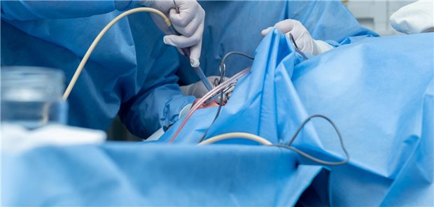 Ein HNO-Arzt führt eine Adenotonsillektomie (Entfernung der Mandeln) in einer sterilen Operationsumgebung durch.