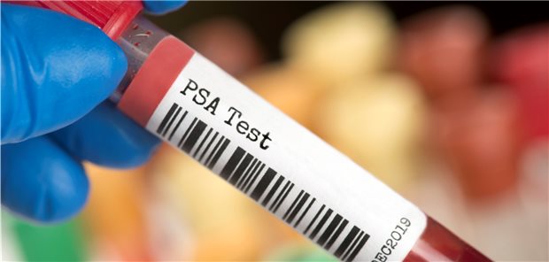 Urologen sehen IQWiG-Abschlussbericht zum PSA-Screening kritisch Zankapfel PSA-Screening: Auch der Abschlussbericht des IQWiG löst Kritik aus.