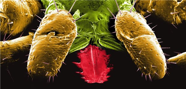 Wo Lyme-Borreliose besonders häufig diagnostiziert wird Zecken als Überträger von Borrelien breiten sich immer weiter aus.