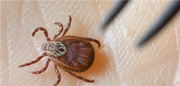 6.000 Behandlungen und 19 Tote wegen Zeckenbissen in Deutschland Eine Zecke krabbelt auf der Haut eines Menschens