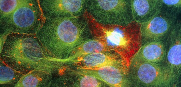 Protonen und Photonen ähnlich toxisch Zellen des Prostatakarzinoms, immunfluoreszierend umter dem Lichtmikroskop.