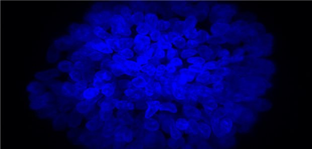 Menschliches Pankreas im Kleinformat entwickelt Zellkerne eines menschlichen Organoids der Bauchspeicheldrüse.