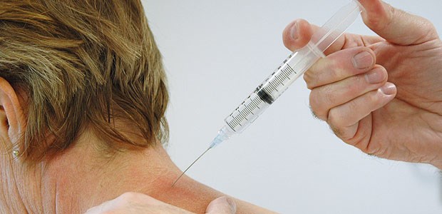Injektionstherapie bietet Chancen Zervikale Spinalnervenanalgesie: Palpieren des Dornfortsatzes C7 (Vertebra prominens) mit dem Daumen der Gegenhand und Tasten des Pulses der A. subclavia mit den Fingern.