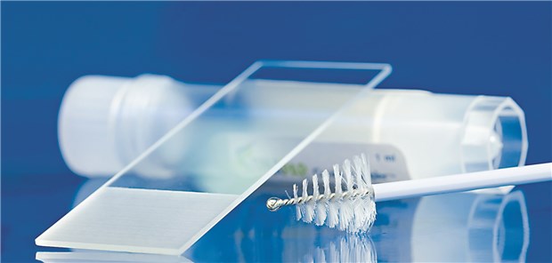 Zervixkarzinom-Screening: Künftig soll Frauen in Deutschland alle drei Jahre eine Untersuchung angeboten werden, die einen HPV-Test und die zytologische Untersuchung kombiniert.