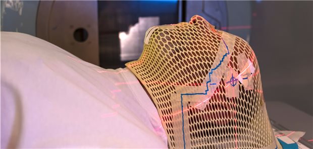 Zielgerichtete Bestrahlung von Hirntumoren: Mit einer Maske wird der Kopf in der exakten Position gehalten.