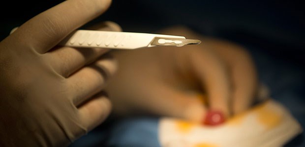 Urologen gehen in die Offensive Zirkumzision: Ein Reizthema beim Öffentlichkeitsforum des Urologenkongresses in Dresden.