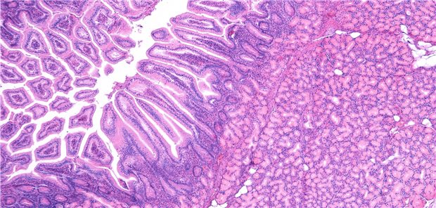 Zotten und Krypten im Dünndarm.