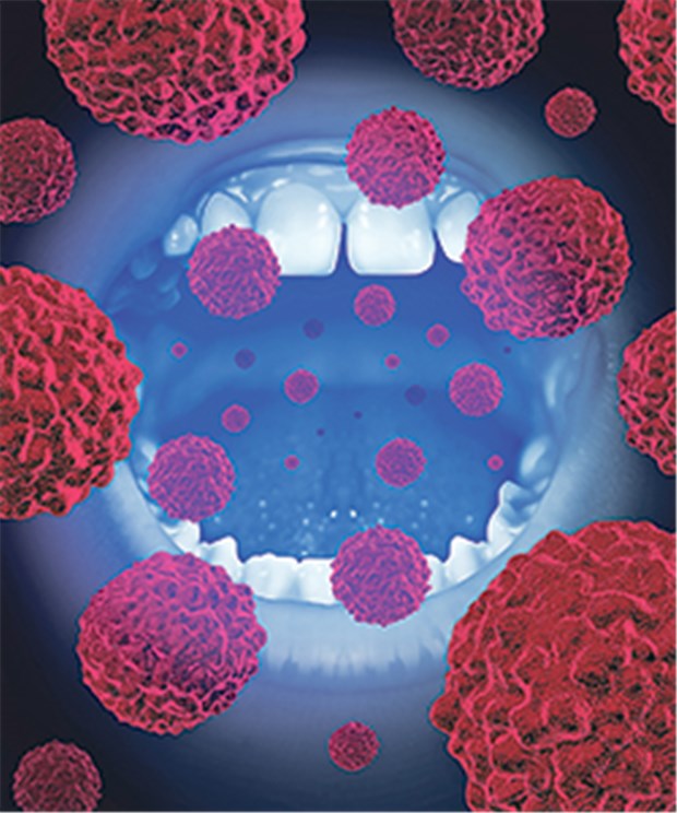 Symptome auch an unerwarteten Stellen Zu den Erkrankungen, die über den Speichel übertragen werden, zählen Infektionen mit Herpes-Viren sowie mit dem Epstein-Barr-Virus.