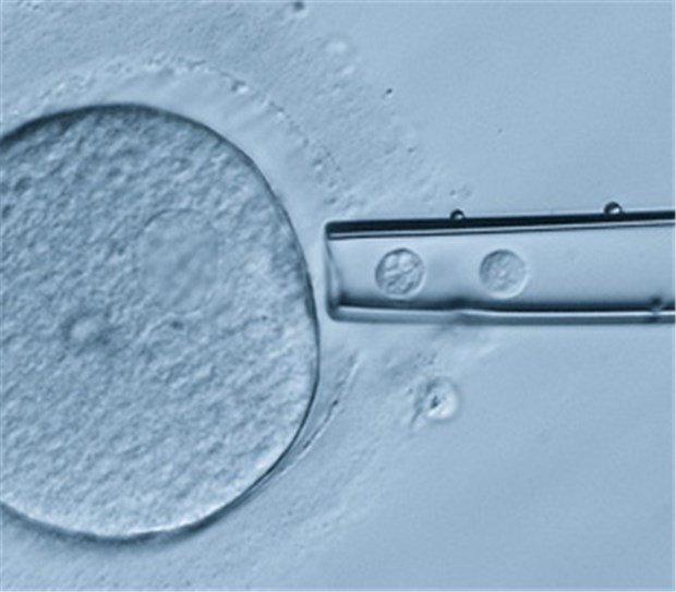 Union und FDP streiten über PID-Zulassung Zu diagnostischen Zwecken werden mit der Pipette Polkörperchen von einer Eizelle entnommen.