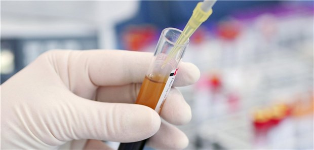 Zu knapp kalkulierte EBM-Leistung? Die Kritik an der Laborreform reißt nicht ab – auch wegen der verschärften Quotierung.