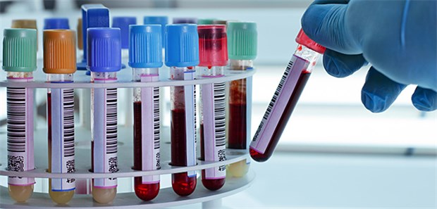 Zum 1. April findet die Laborreform statt. Der ALM e. V.-Vorsitzende sieht diese kritisch, weil sie die falschen Anreize setze.