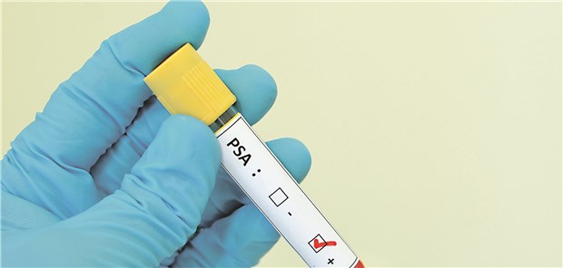 Zum initialen PSA-Test wird heute ab 45 geraten, mit Kontrollen abhängig vom Ausgangswert.