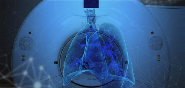 Zumindest initial einmal ein hochauflösendes Computertomogramm (HRCT) kann dabei helfen, einer interstitiellen Lungenerkrankung auf die Spur zu kommen.