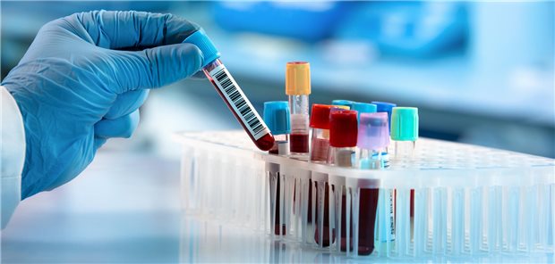 Zur Altersbestimmung braucht niemand einen Bluttest, dafür gibt es die Geburtsurkunde. Aber für die nähere Bestimmung des Risikostatus altersbedingter Erkrankungen kann es sinnvoll sein, genauer nachzuschauen. Wer einmal seinen Longevity-Tätigkeitsschwerpunkt erworben hat, kann sich durch Fortbildungen immer tiefer in dieses „In-Thema“ einarbeiten – und so sein medizinisches Spektrum erweitern. 