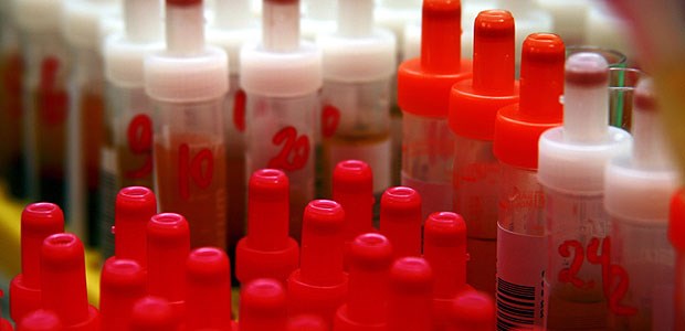 BNP-Messung gegen Herzschwäche Zur BNP-Messung wird EDTA-Serum verwendet.