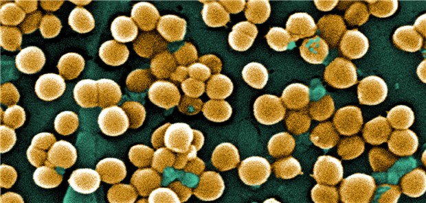 Zur Sanierung freigegeben: Besiedelte Patienten sollen im Projekt „STAUfrei“ vor der stationären Aufnahme saniert werden.