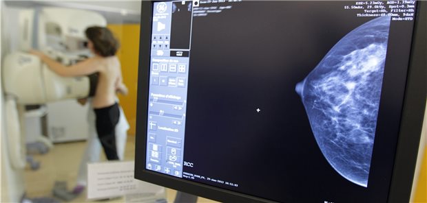 Zur Stärkung der onkologischen Früherkennung empfehlen die Chefberater der EU-Kommission, europwaeit auch Frauen unter 50 in Mammografie-Screening-Programme einzubinden.