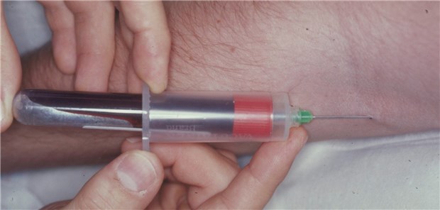 Zur Vermeidung von Nadelstichverletzungen dürfen Ärzte ab sofort Hilfsmittel mit einem Sicherheitsmechanismus verordnen.