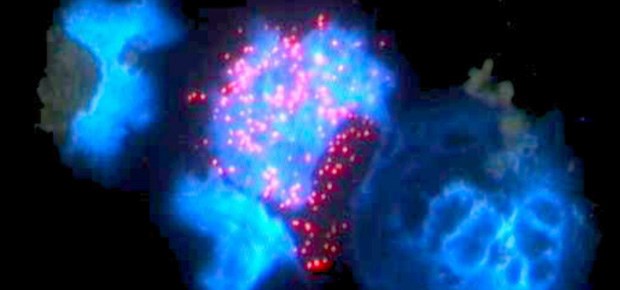 Statt Lorenzos Öl: Gentherapie mit HIV Zwei Jahre nach der Gentherapie bilden die Blutstammzellen der behandelten Kinder immer noch das ALD-Protein (pink).