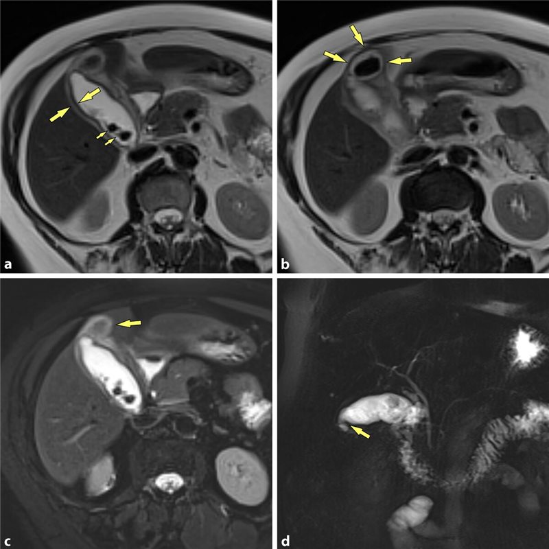 Die Phrygische Mütze Nicht nur eine Kopfbedeckung