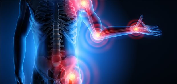 Editorial des Dossiers für die maßgeschneiderte Osteoporosetherapie empfiehlt Dr. Natasha Appelman-Dijkstra ein Assessment vertebraler Frakturen (VFA) zusätzlich zur DXA-Messung. Ein VFA ist dabei mit demselben Gerät möglich. Das ist nur einer der Ratschläge der Ärztin von der Universität Leiden in den Niederlanden.Lesen Sie außerdem in diesem Sonder-Telegramm zu Osteoporose, wie sich die Osteoporose-Leitlinie für postmenopausale Frauen und Männer ab 50 mit der Aktualisierung verändert hat. Und auch hinsichtlich der Verschreibung von Calciumverbindungen und Vitamin D bei Osteoporose hat der Gemeinsame Bundesausschuss Neues im Sinn.