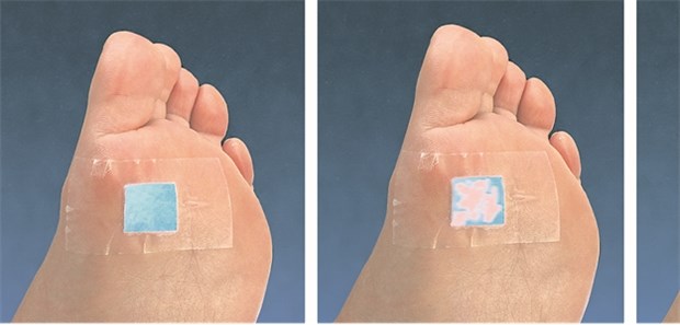 Spezialpflaster zur Neuropathie-Früherkennung in Farbumschlag von Blau nach Pink zeigt eine normale Schweißsekretion am Fuß an. Bleibt das Infikator-Pflaster blau, kann das ein Zeichen einer diabetischen peripheren Neuropathie sein.