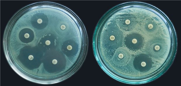 kirby bauer method. Antibiotic Sensitivity Test. Methods in Detecting Antimicrobial Resistance using petri dish. multidrug resistanceUsage: Online (20211011)