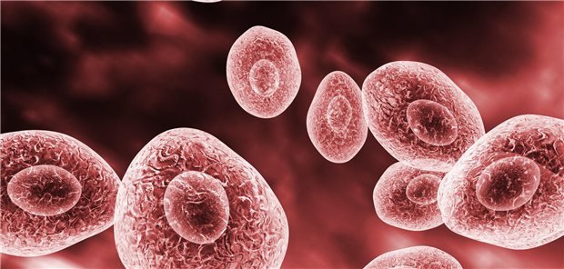 Selten, aber lebensbedrohlich: Invasive Pilzinfektionen bei rheumatoider Arthritis Dreidimensionale Illustration von Pneumocystis jirovecii, ein opportunistischer Pilz, der bei immunsuppremierten Patienten Lungenentzündung verursachen kann.
